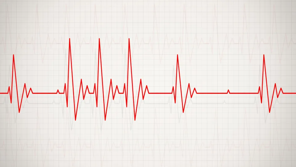 Patient med långtids-EKG-utrustning på GlobenHeart i Stockholm