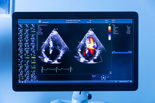 Ultraljudsundersökning av hjärtat — ekokardiografi på GlobenHeart i Stockholm