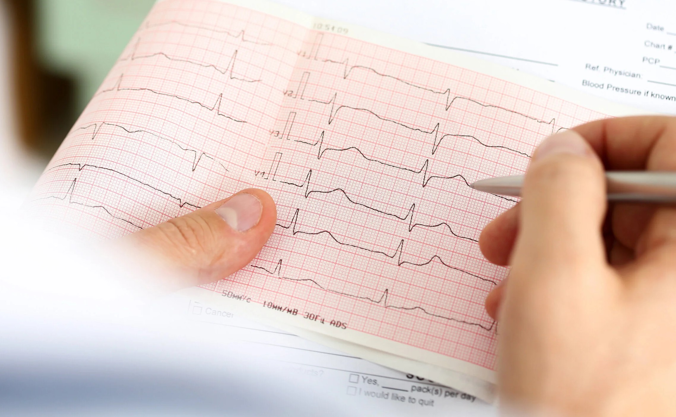 Vilo-EKG – den enklaste hjärtundersökningen på GlobenHeart i Stockholm