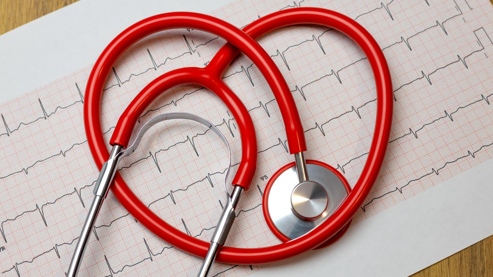 Vad skiljer vilo-EKG, arbets-EKG och långtids-EKG åt? Skillnaderna förklarade och när varje undersökning används, GlobenHeart Stockholm.